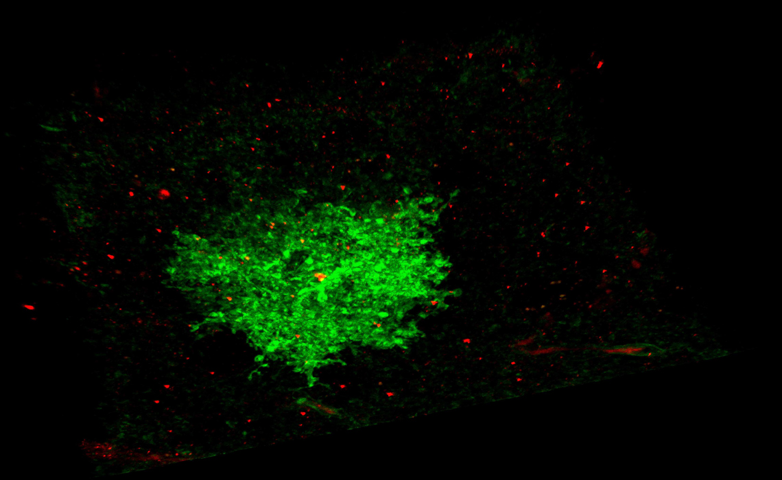 In this photo the astrocyte appears green and the synaptic proteins appear red.