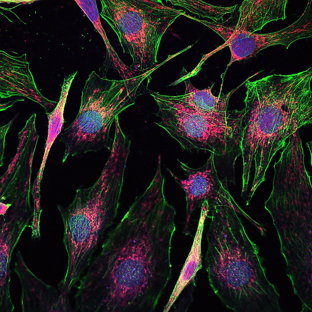 Colourful kaleidoscope of muscle cells under a microscope